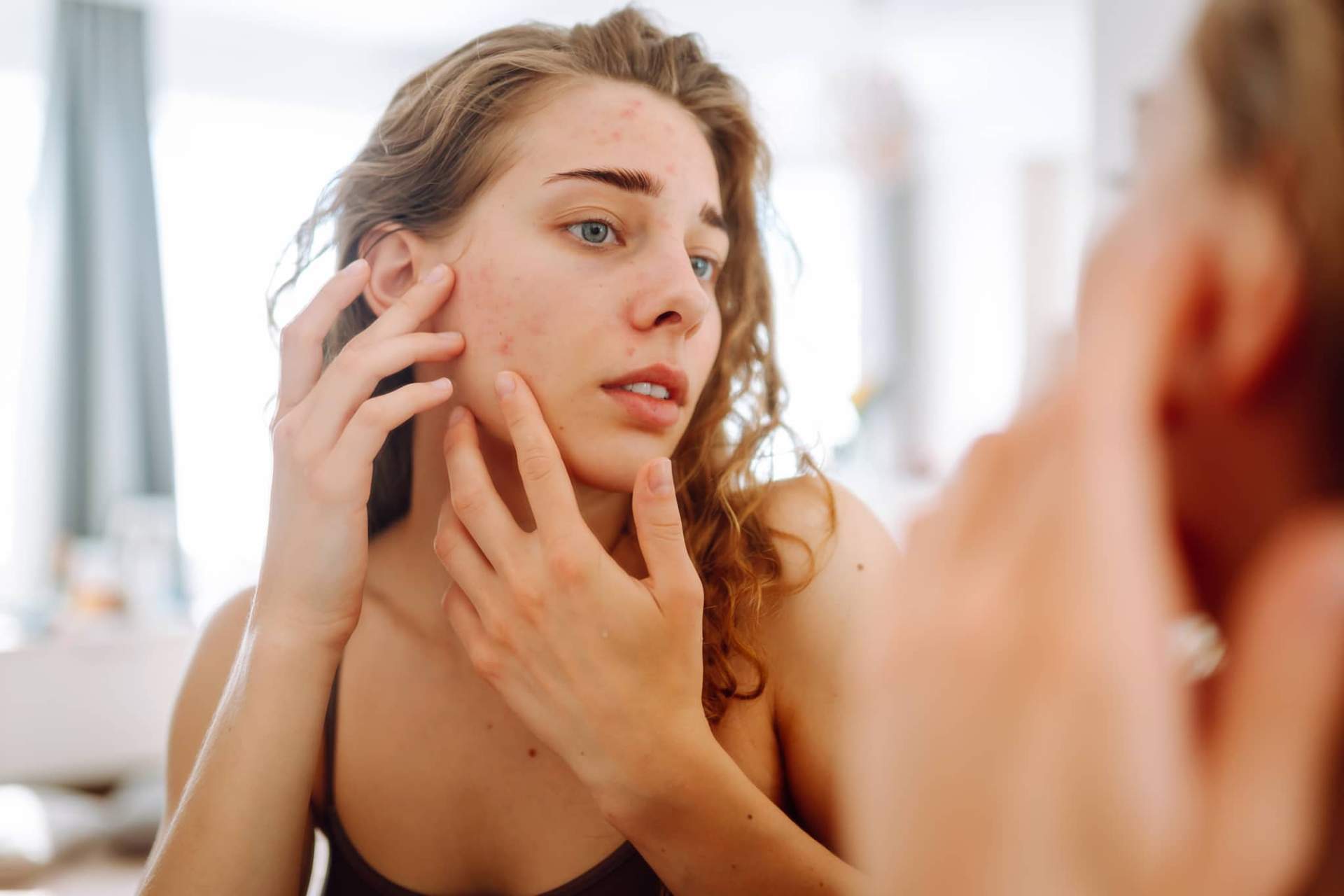 À quoi ressemble un visage marqué par le gluten et le sucre ? Votre peau reflète votre alimentation — Visage