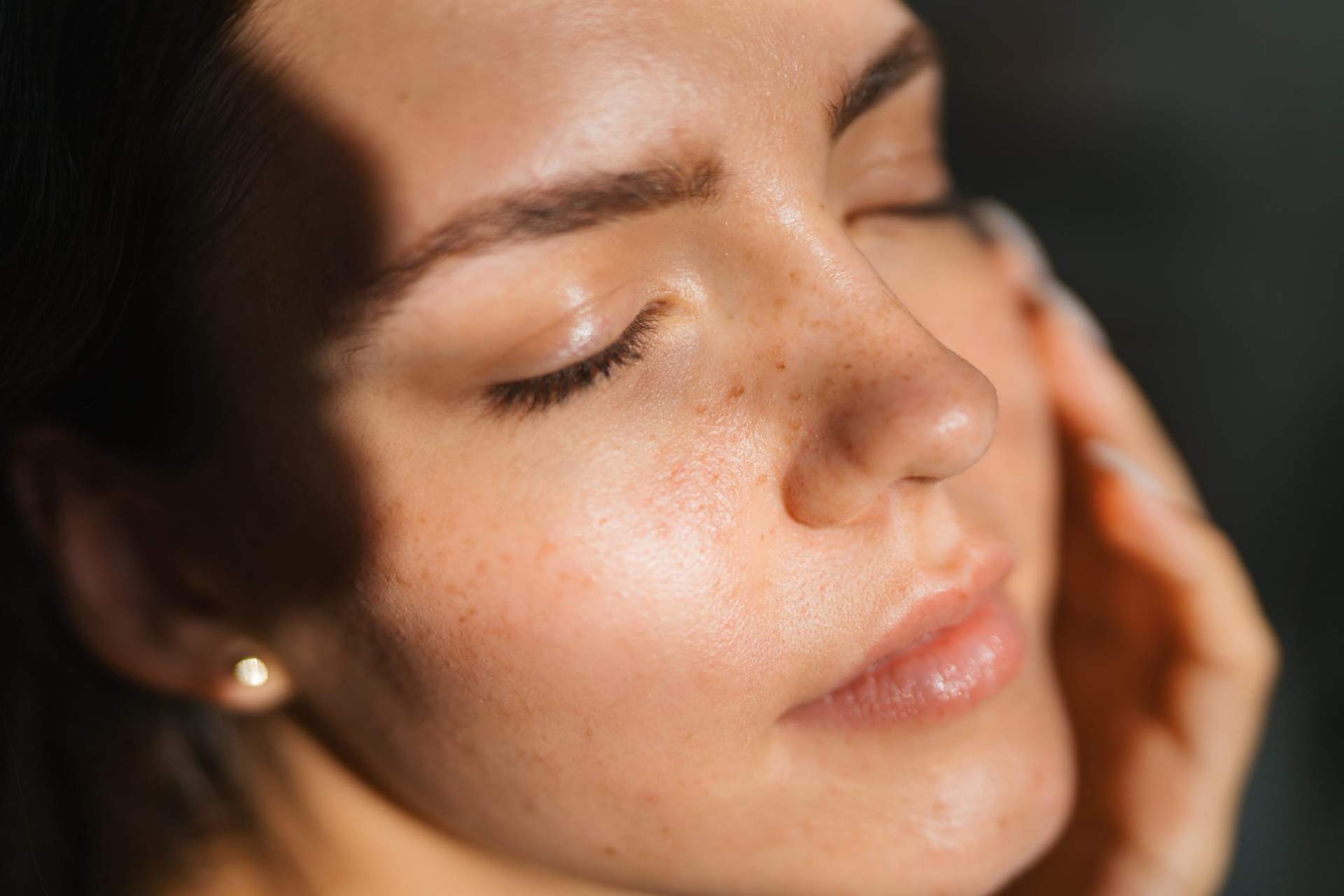 Ce que ton cœur ressent, ta peau l'exprime : les causes émotionnelles des problèmes de peau — Santé