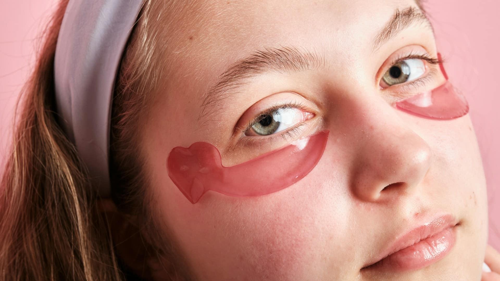 5 bewährte Hausmittel gegen dunkle Augenringe — Gesicht