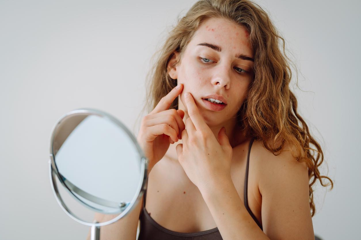 Boutons, sécheresse, éclat : voici comment votre peau change à chaque phase du cycle menstruel — Santé